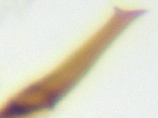 Anaceratagallia ribauti